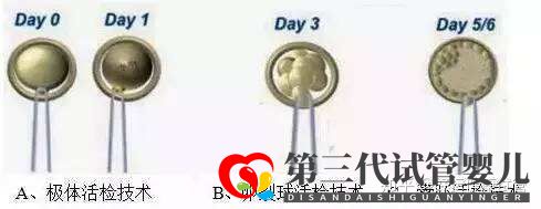 三代試管知男女的必經(jīng)之路—胚胎活檢術(圖1)