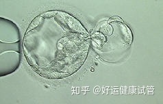 三代試管知男女的必經(jīng)之路—胚胎活檢術(圖4)