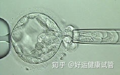 三代試管知男女的必經(jīng)之路—胚胎活檢術(圖5)