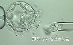 三代試管知男女的必經(jīng)之路—胚胎活檢術(圖6)