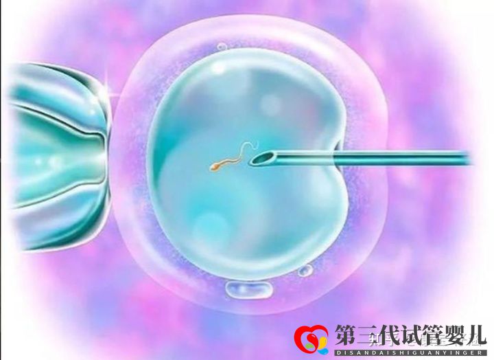 通俗易懂的一、二、三代試管嬰兒解說(shuō)(圖2)