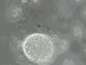 精子碎片率高可以做三代試管嬰兒?jiǎn)幔?圖1)