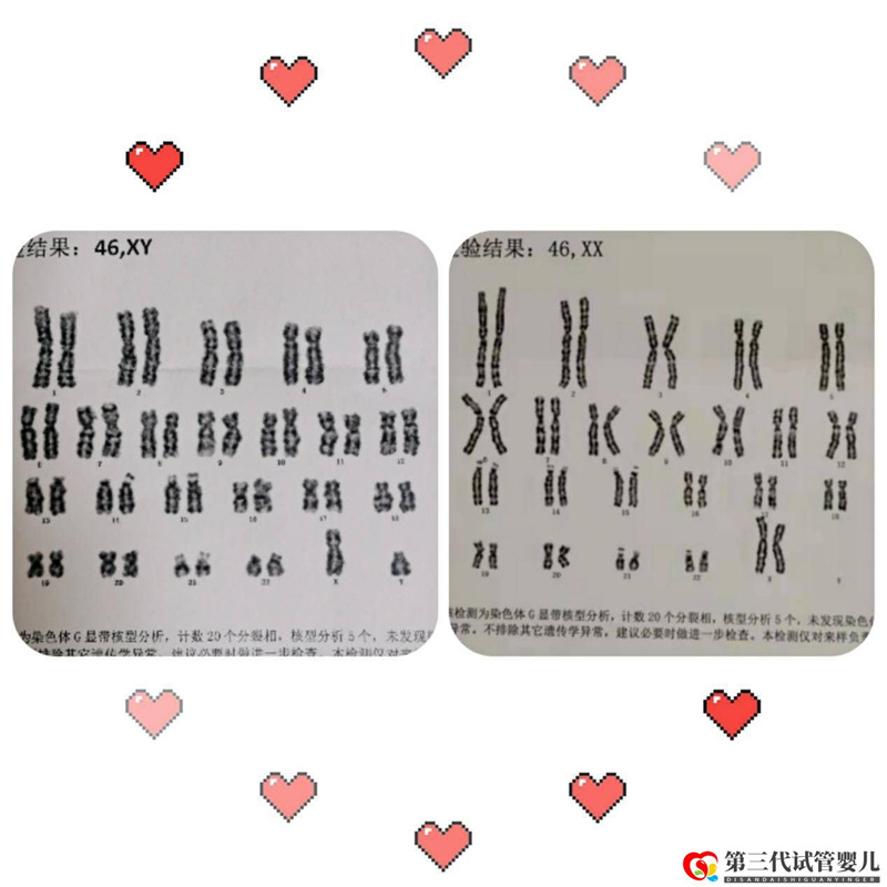 為什么父母染色體正常，胚胎染色體卻有問題？(圖1)