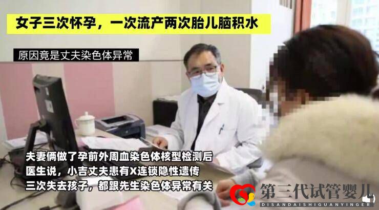 女子三次懷孕一次流產(chǎn)兩次胎兒腦積水原因竟是丈夫染色體異常(圖2)