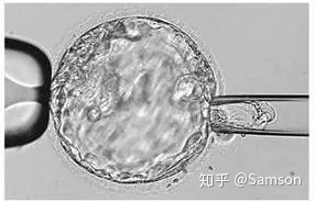 第三代試管嬰兒真的最好最先進(jìn)嗎國內(nèi)哪里可以做(圖3)