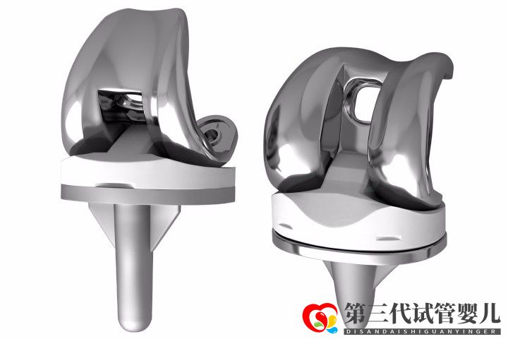 人工膝關(guān)節(jié)置換手術(shù)成功率大嗎？膝關(guān)節(jié)置換手術(shù)成功率有多高？(圖1)