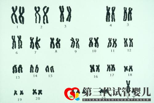 夫妻染色體正常，試管胚胎染色體異常的三個原因你都知道嗎？(圖2)