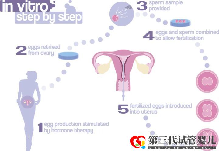 試管嬰兒1代、2代、3代、4代哪個最好真實(shí)操作過...(圖4)