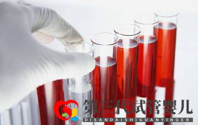 肝功檢查可以篩查肝癌嗎(圖1) 肝功檢查可以篩查肝癌嗎(圖1)