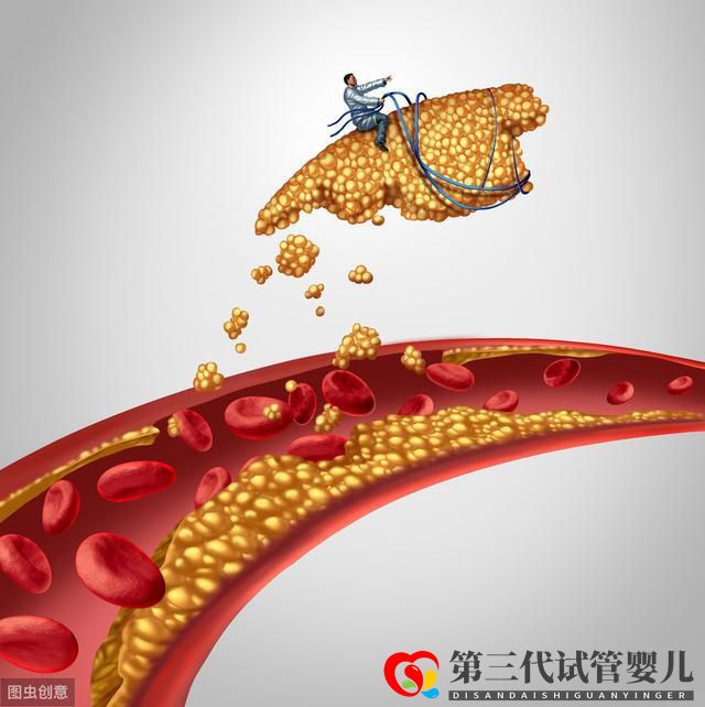 頸動脈斑塊篩查，能降低心腦血管事件發(fā)生嗎？(圖2)