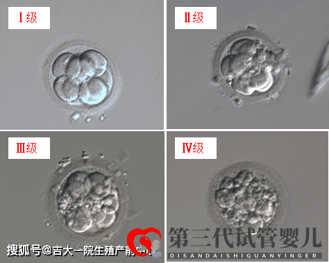 胚胎能看出來男女嗎？(圖1)