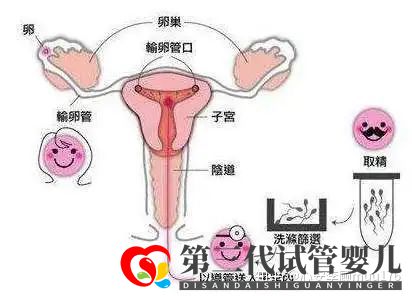 人工授精跟試管嬰兒的區(qū)別(圖5)
