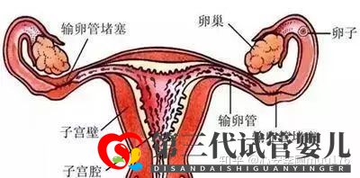 人工授精跟試管嬰兒的區(qū)別(圖3)