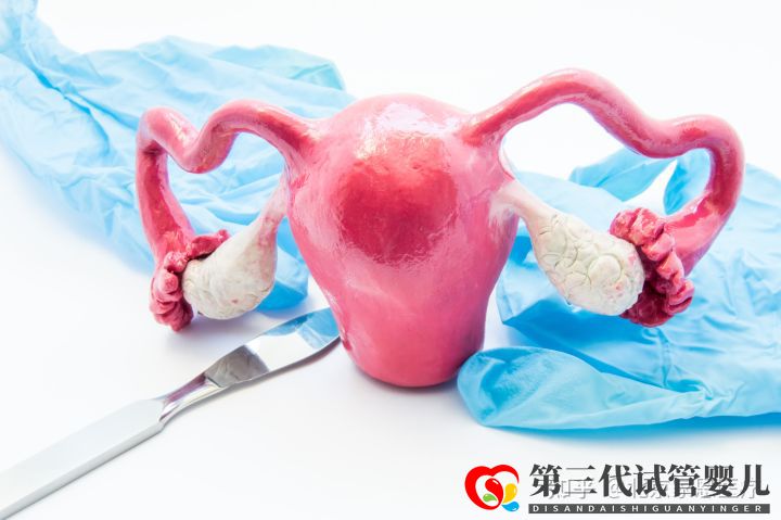 輸卵管堵塞是先疏通還是直接試管(圖2)