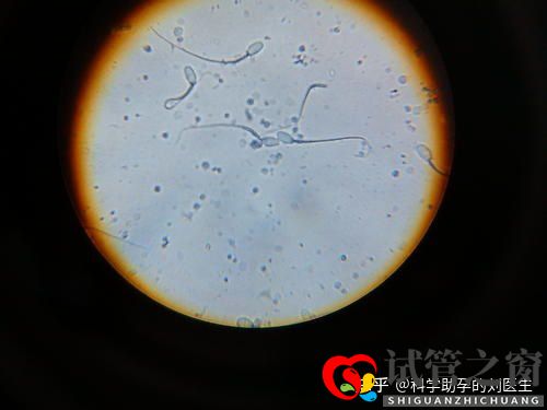 做試管嬰兒的全過程做三代試管嬰兒預備10萬夠不夠(圖7) 做試管嬰兒的全過程做三代試管嬰兒預備10萬夠不夠(圖7)