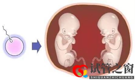 做試管嬰兒，一次移植兩個(gè)生雙胞胎好不好？(圖3)