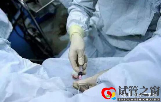 直擊試管嬰兒的過程(圖6) 直擊試管嬰兒的過程(圖6)