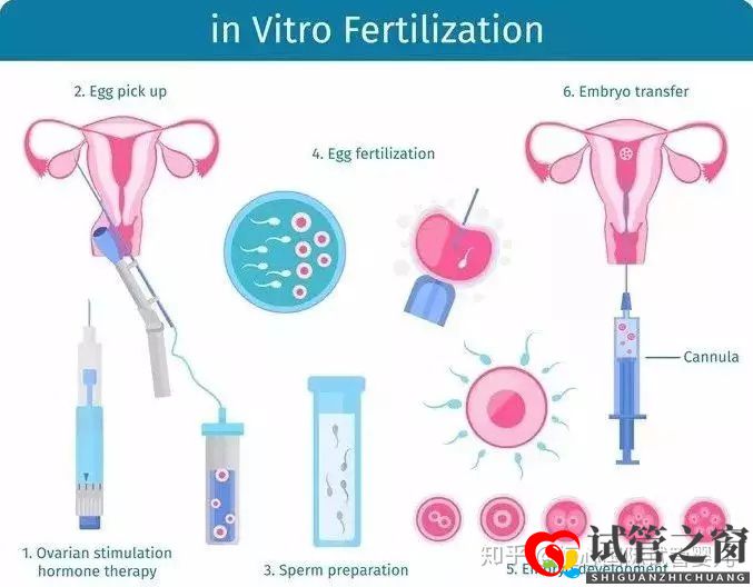 做一個試管嬰兒要花多少錢醫(yī)保能報銷嗎(圖3) 做一個試管嬰兒要花多少錢醫(yī)保能報銷嗎(圖3)