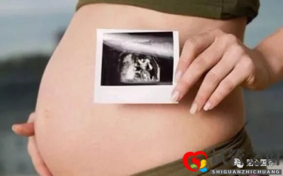 高齡選擇做第三代試管嬰兒注意事項有哪些？(圖1)