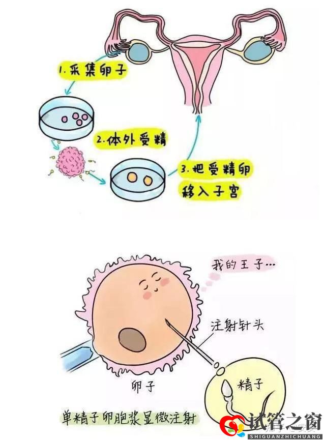 “試管嬰兒又不是親生的,多丟人”(圖1)