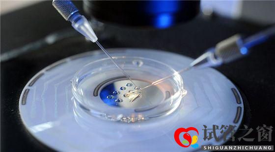 多囊卵巢綜合癥能做試管嬰兒?jiǎn)?圖1) 多囊卵巢綜合癥能做試管嬰兒?jiǎn)?圖1)