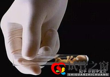 靠試管嬰兒生寶寶首先要滿(mǎn)足6個(gè)標(biāo)準(zhǔn)(試管嬰兒怎么做的全過(guò)程)(圖1) 靠試管嬰兒生寶寶首先要滿(mǎn)足6個(gè)標(biāo)準(zhǔn)(試管嬰兒怎么做的全過(guò)程)(圖1)