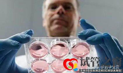 靠試管嬰兒生寶寶首先要滿(mǎn)足6個(gè)標(biāo)準(zhǔn)(試管嬰兒怎么做的全過(guò)程)(圖3) 靠試管嬰兒生寶寶首先要滿(mǎn)足6個(gè)標(biāo)準(zhǔn)(試管嬰兒怎么做的全過(guò)程)(圖3)
