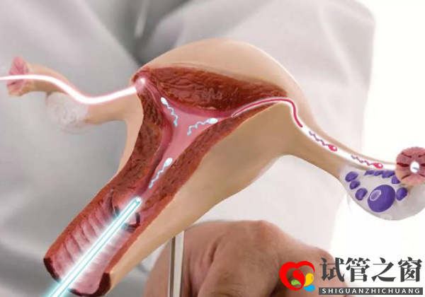 卵子老化的大齡女性看過來,第四代試管嬰兒幫你圓夢(圖2) 四代試管也就是三親試管