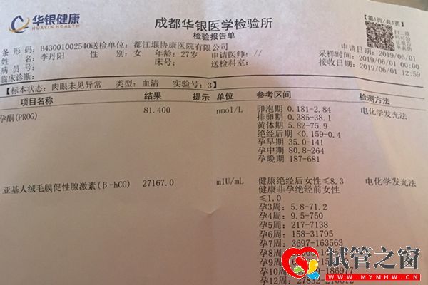 女性驗(yàn)孕檢驗(yàn)報(bào)告單