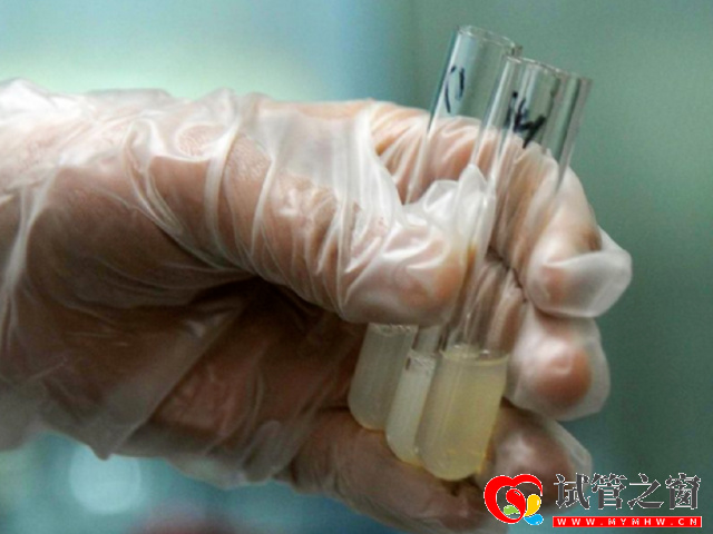 精子顏色為灰白或者是淡黃色的