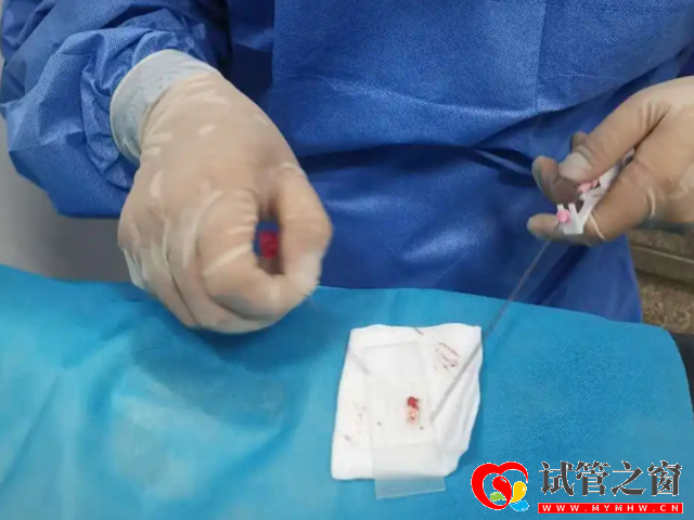 睪丸穿刺是經(jīng)過皮膚對睪丸進行穿刺