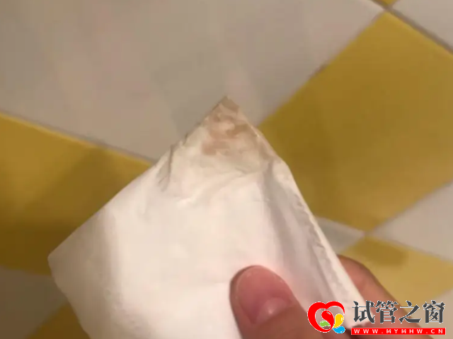 著床成功的褐色分泌物