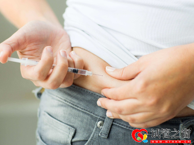 試管促排卵費(fèi)用在一直兩萬(wàn)元左右