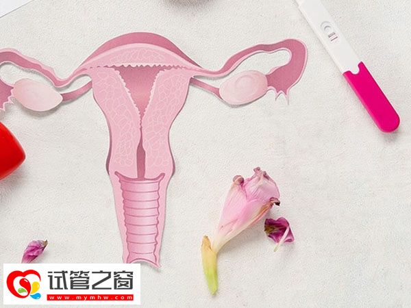 子宮內(nèi)膜是否異位要做什么項(xiàng)目