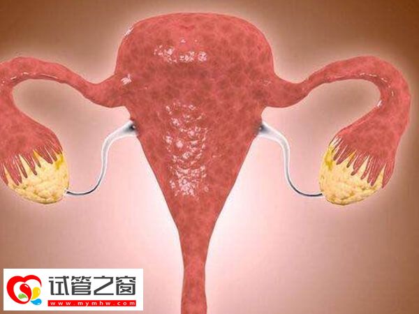 子宮內(nèi)膜異位有哪些表現(xiàn)