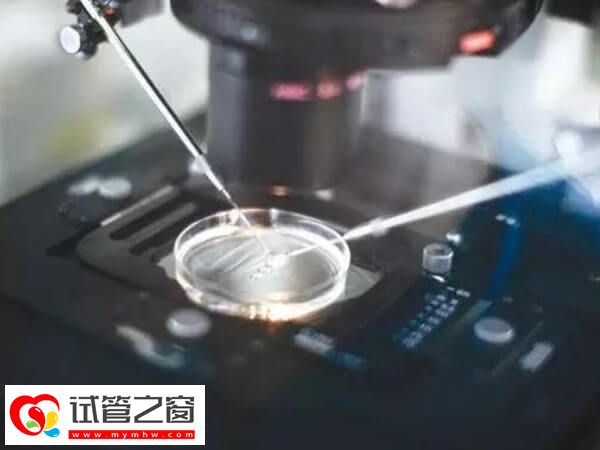 涿州醫(yī)院做試管嬰兒成功率不低
