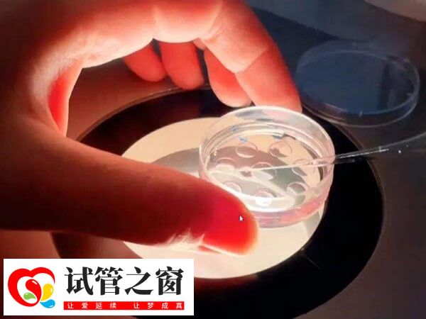 囊胚移植兩個可能懷雙胞胎