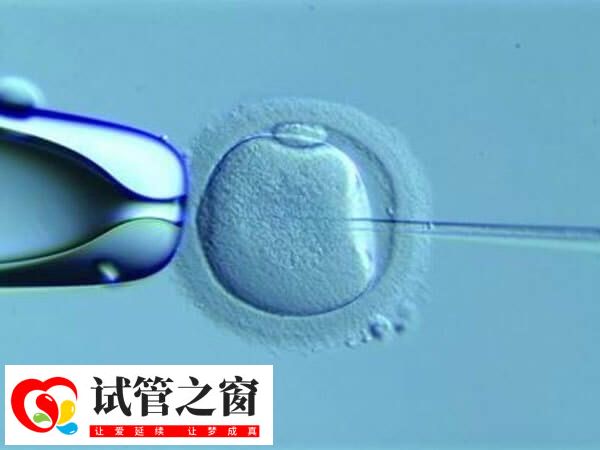 試管嬰兒選擇方案因人而異