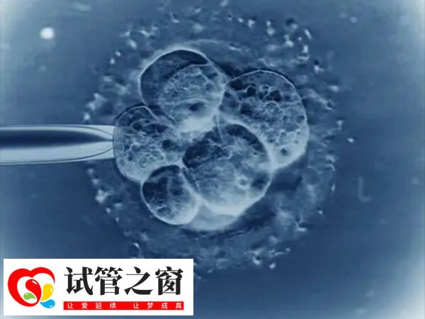 試管嬰兒短方案用藥時(shí)間短