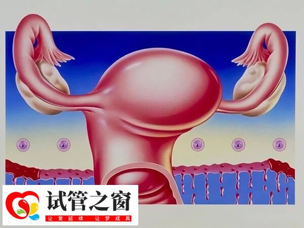 卵巢過激是試管嬰兒常見的并發(fā)癥