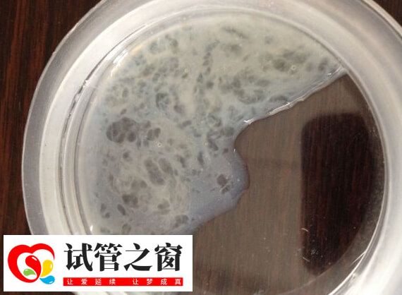 精子活力三級(jí)是精子直線前進(jìn)