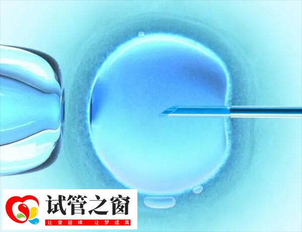 單精子注射是一種顯微操作技術(shù)