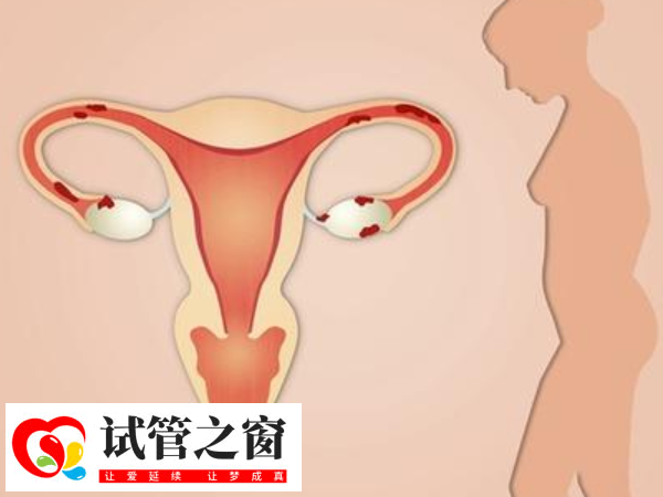 子宮內(nèi)膜厚度均勻正常