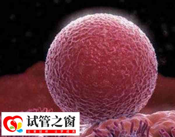 泰國試管嬰兒多胎妊娠容易引發(fā)早產(chǎn)