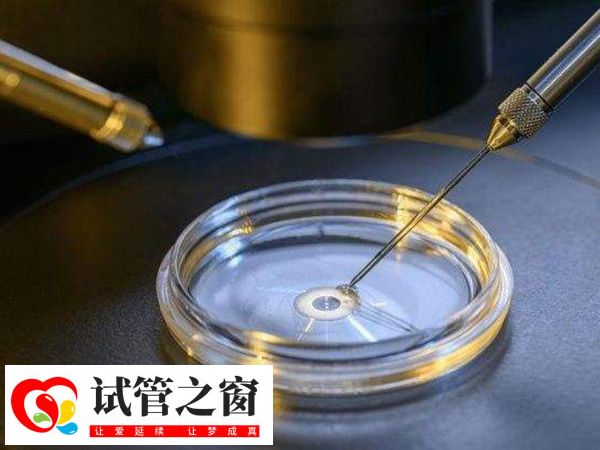 三代試管嬰兒涉及多個(gè)環(huán)節(jié)