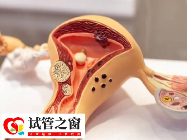 囊胚最晚著床時(shí)間在移植7-10天內(nèi)