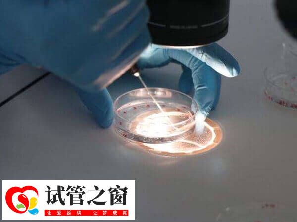 養(yǎng)囊的具體的費用會根據(jù)醫(yī)院收費標準而異