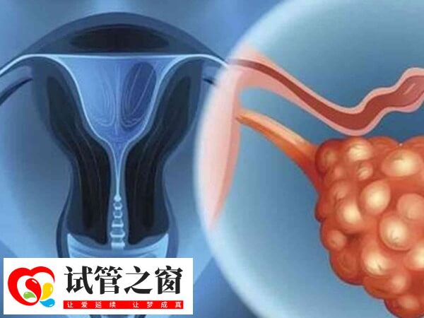 囊胚移植后尿頻可能是感染