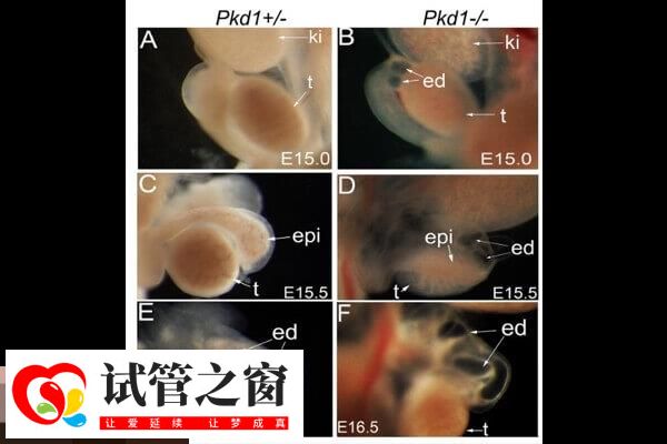 PKD1基因又叫多囊腎相關(guān)基因