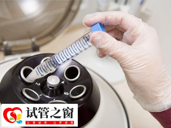 試管移植后的著床時(shí)間并不固定